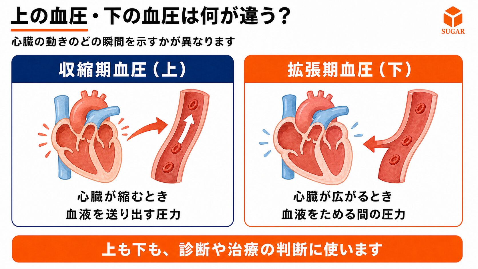 収縮期血圧(上)と拡張期血圧(下)について、心臓の動きのどの瞬間を示すかと、どちらも診断・治療の判断に使うことを比較した図